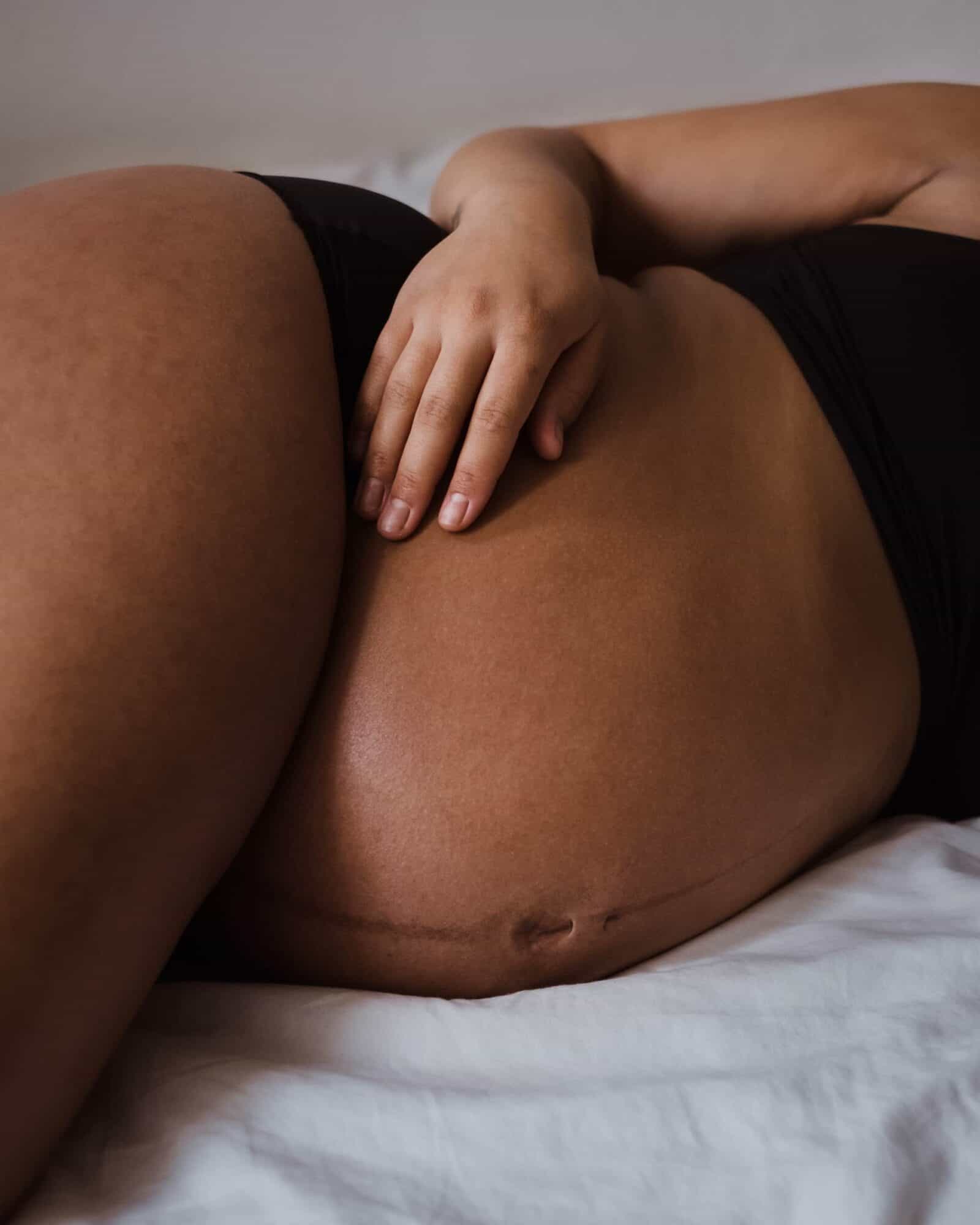 comment éviter les vergetures pendant la grossesse : femme enceinte allongée sur un lit